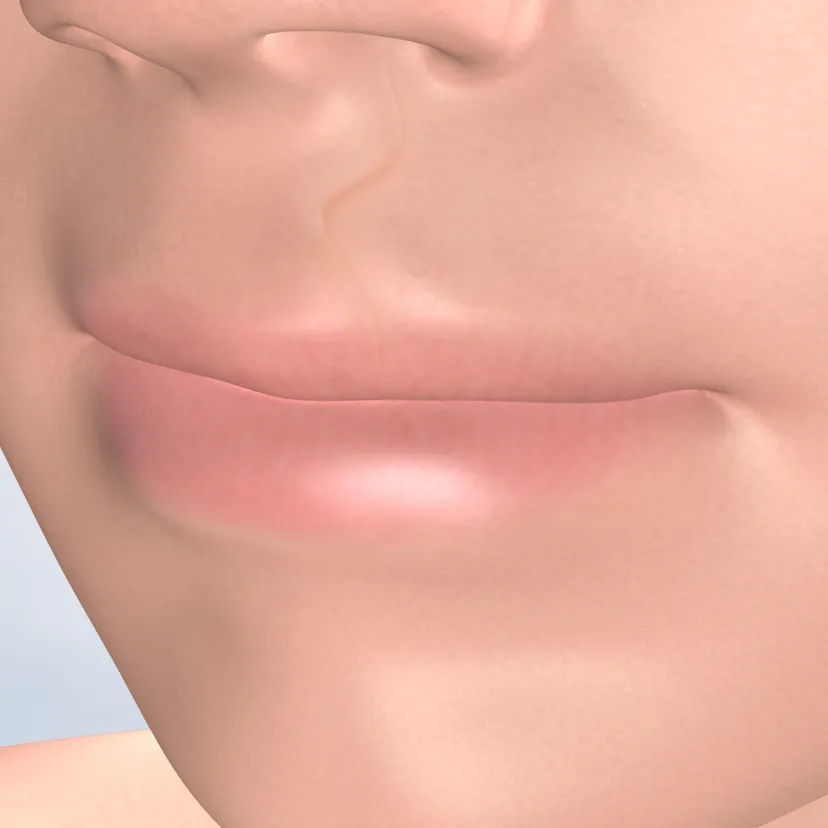 Cleft lip and cleft palate in Fresno, Clovis, Reedley, and Madera, CA
