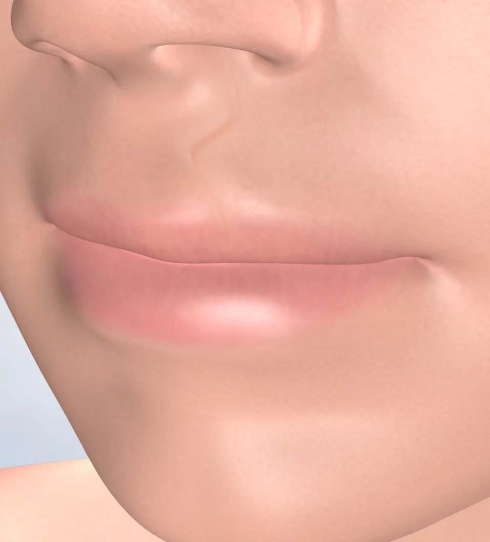Cleft lip and cleft palate in Fresno, Clovis, Reedley, and Madera, CA