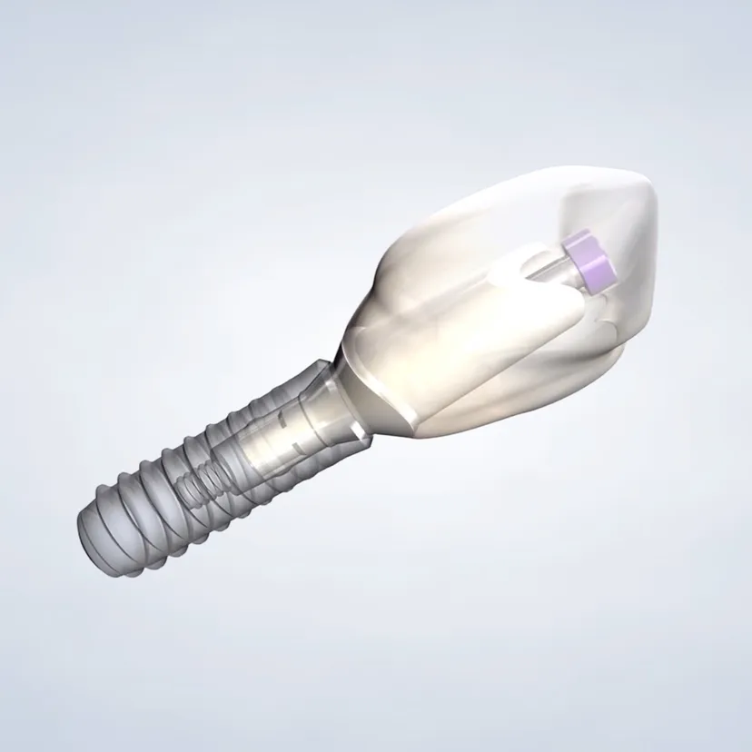 Dental Implants in Fresno, Clovis, Reedley, and Madera, CA