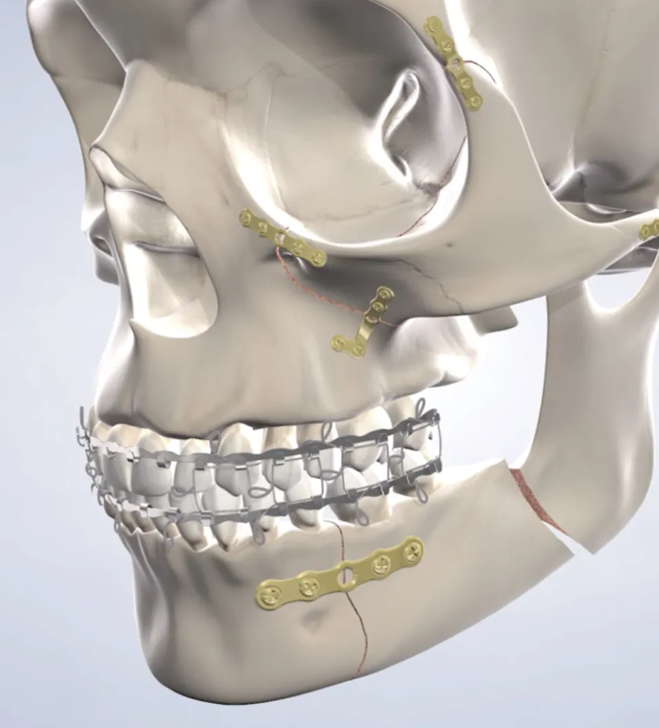 Facial trauma treatment in Fresno, Clovis, Reedley, and Madera, CA