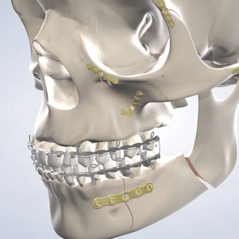 Facial trauma treatment in Fresno, Clovis, Reedley, and Madera, CA