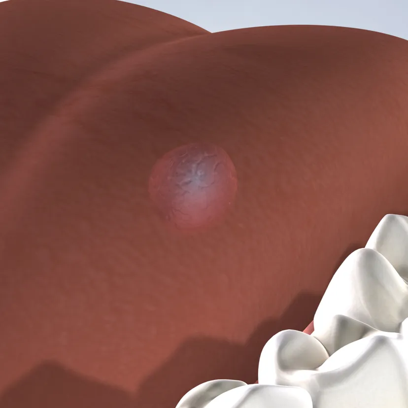 Oral pathology in Fresno, Clovis, Reedley, and Madera, CA