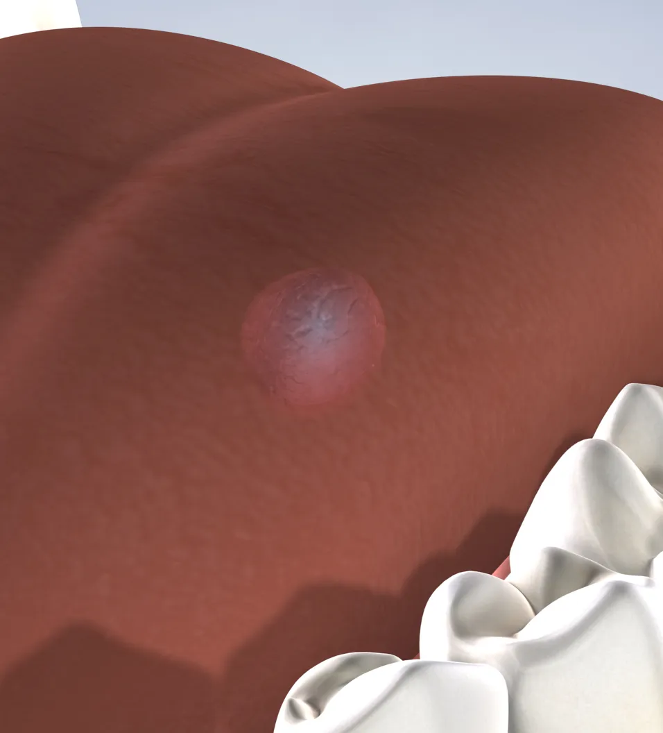 Oral pathology in Fresno, Clovis, Reedley, and Madera, CA