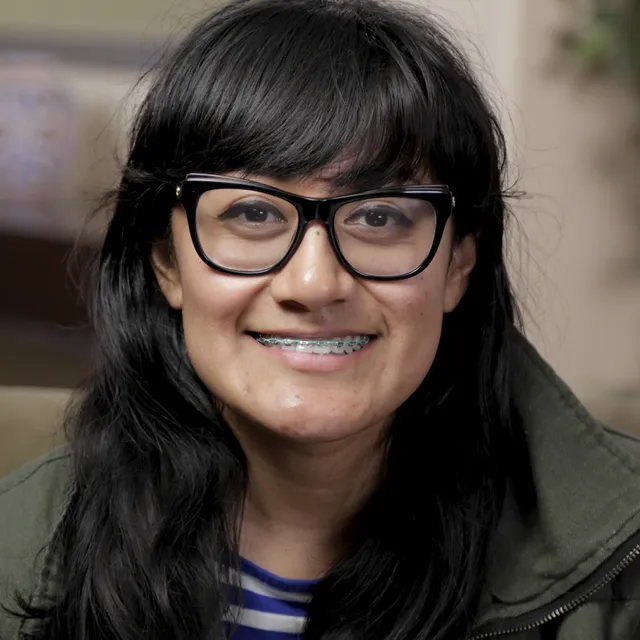 Erika underwent jaw surgery in Fresno, CA.