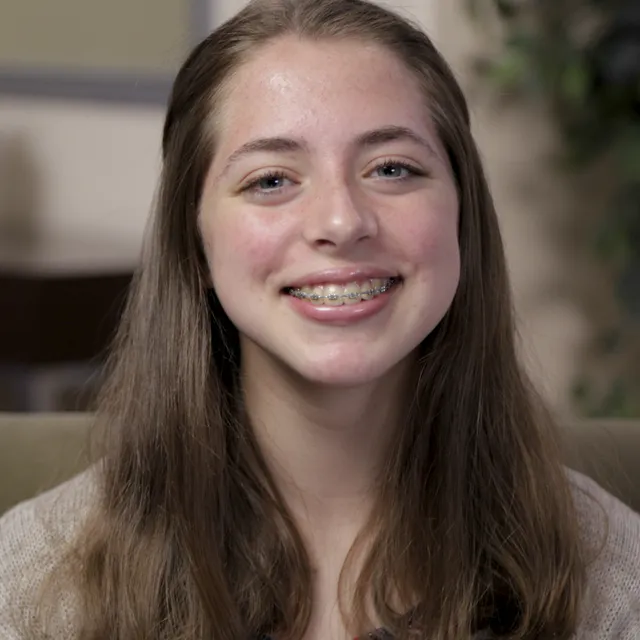 Megan underwent jaw surgery in Fresno, CA.